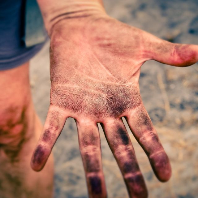 削去手指表面皮肤能消除指纹吗？